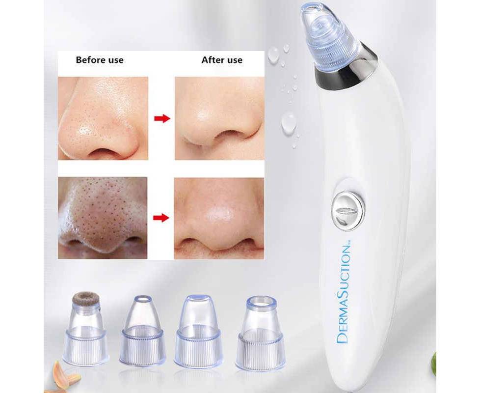 Blackhead Extractor utilizing Electric Vacuum Suction for Facial Cleansing